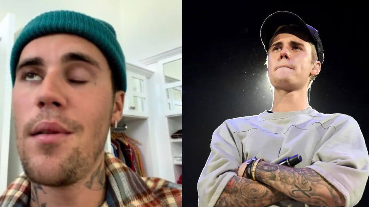 Justin Bieber Hits With Ramsay Hunt Syndrome